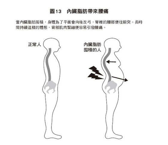 小腹突出易腰痛千萬別忽略內臟脂肪囤積的問題 康健雜誌