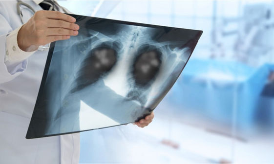 最新 癌症蟬聯十大死因之首 但 這疾病 增加比率最高 康健雜誌 最新 癌症蟬聯十大死因之首 但 這疾病 增加比率最高 康健雜誌