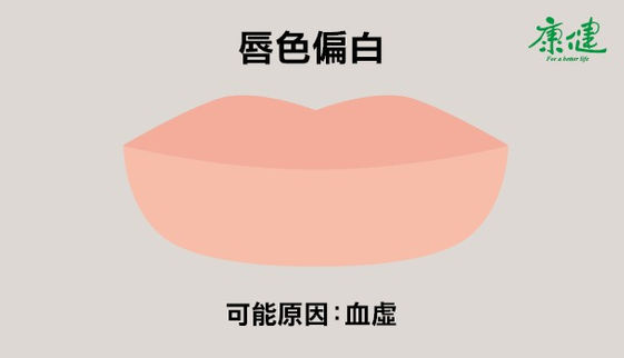 嘴唇發黑發紫是什麼狀況 ６種唇色看健康 康健雜誌
