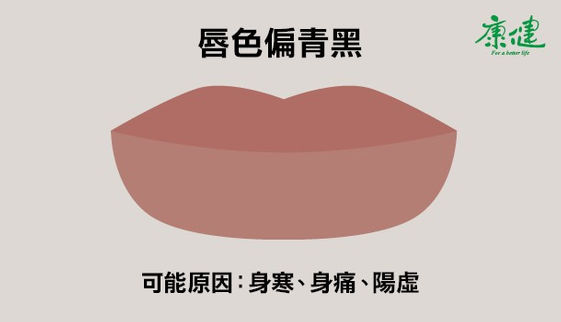 嘴唇發黑發紫是什麼狀況 ６種唇色看健康 康健雜誌