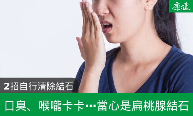 扁桃腺結石是什麼 口臭 喉嚨卡 2招清理扁桃腺結石 康健雜誌 扁桃腺結石是什麼 口臭 喉嚨卡 2招清理扁桃腺結石 康健雜誌