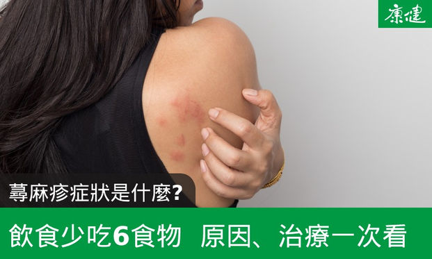 慢性 蕁 麻疹 原因
