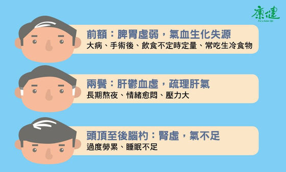 白髮是智慧的象徵 3部位冒白髮 小心健康出狀況 康健雜誌