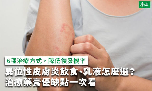 異位性皮膚炎飲食 乳液怎麼選 治療藥膏優缺點一次看 康健雜誌