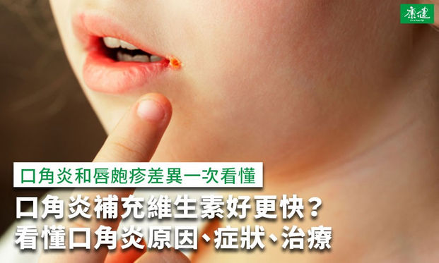 口角炎補充維生素好更快 看懂口角炎原因 症狀 治療 康健雜誌