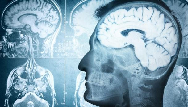 流行性腦脊髓膜炎多可怕 恐全身性血栓 康健雜誌