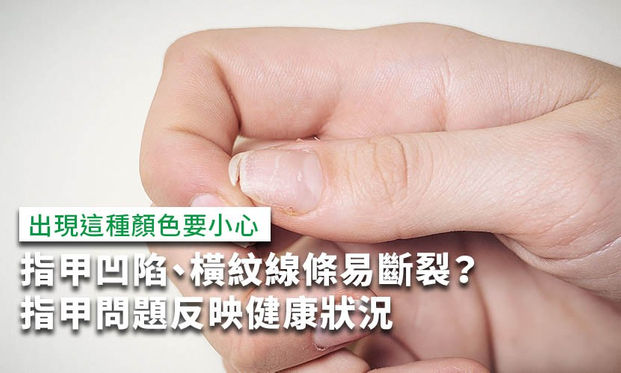 指甲凹陷 出現橫紋直線 變黑 指甲問題反映疾病警訊 康健雜誌 指甲凹陷 出現橫紋直線 變黑 指甲問題反映疾病警訊 康健雜誌