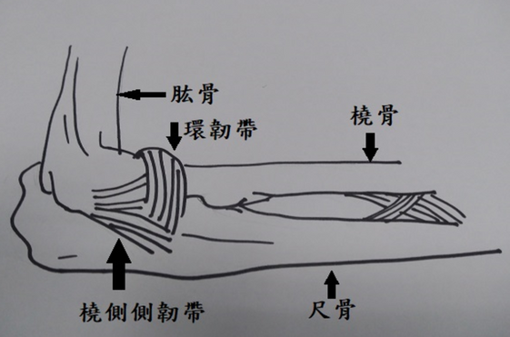 手肘疼痛就是網球肘 醫師 病因可以不單純 康健雜誌