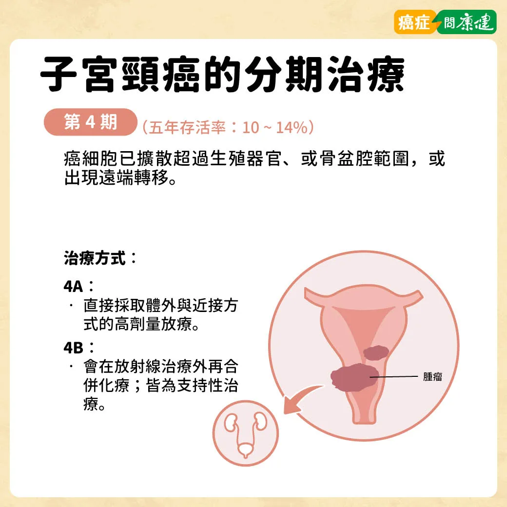 分泌物變多是子宮頸癌症狀?了解子宮頸癌前兆、各期存活率- 癌症問康健 分泌物變多是子宮頸癌症狀?了解子宮頸癌前兆、各期存活率- 癌症問康健