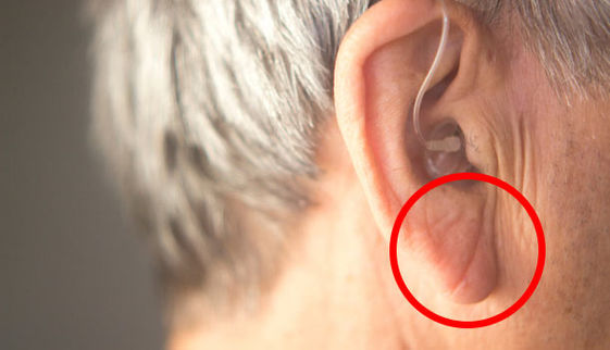 快檢查耳朵 這個位置有褶痕可能是心肌梗塞的徵兆 康健雜誌 快檢查耳朵 這個位置有褶痕可能是心肌梗塞的徵兆 康健雜誌
