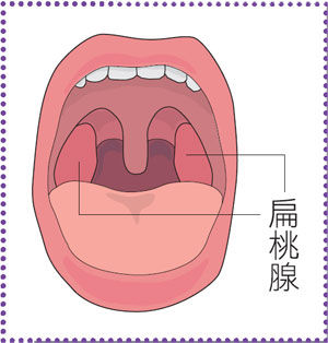 扁桃腺化膿 該怎麼辦 康健雜誌